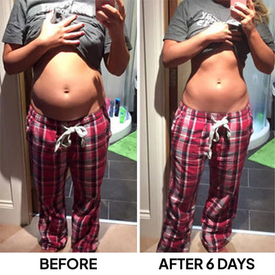 RecoveryBoost™ Digestive Support